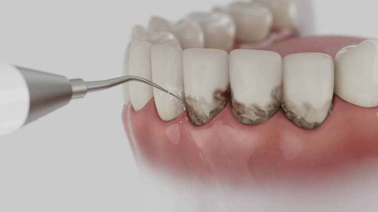 Reliable Dental contractor in Troy, OH by Smile Center Dentistry